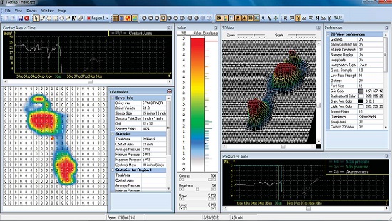 壓力分布儀器足弓檢測的應用